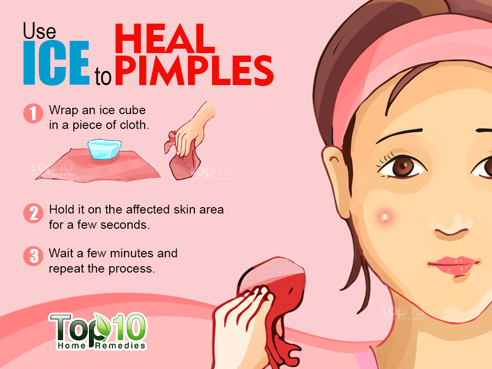 How To Get Rid.of Pimples Fast